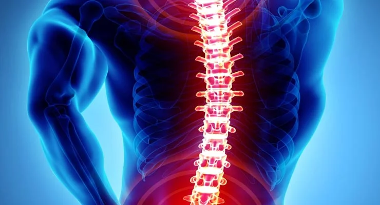 How do you know when you need spine surgery?